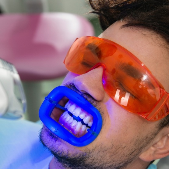 Dental patient receiving professional teeth whitening