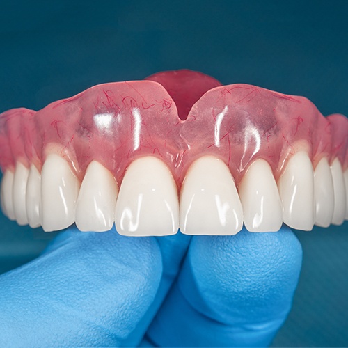 Full set of upper dentures