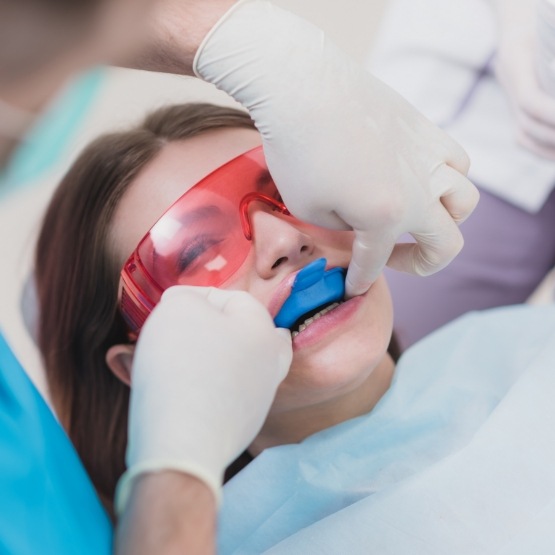 Dental patient having fluoride applied to her teeth