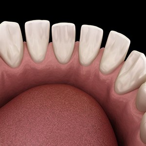 a 3D illustration of gapped teeth